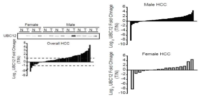 남성 또는 여성 간세포암 환자에서 UBC12의 발현