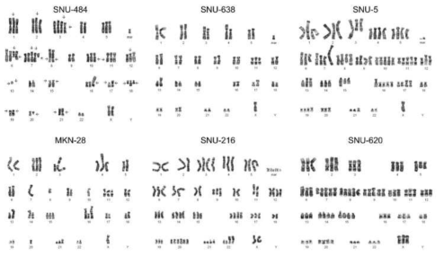 남성/여성 유래 세포주의 핵형 분석