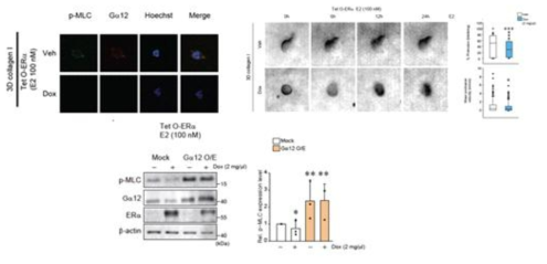 3-Dimensional imaging of Tet O-ERα SK-Hep1 3차원 이미지 분석