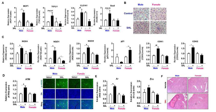 SAL을 투여한 암수 마우스 간조직에서 간질환 관련 유전자 발현 변화 및 Hematoxylin and Eosin 염색