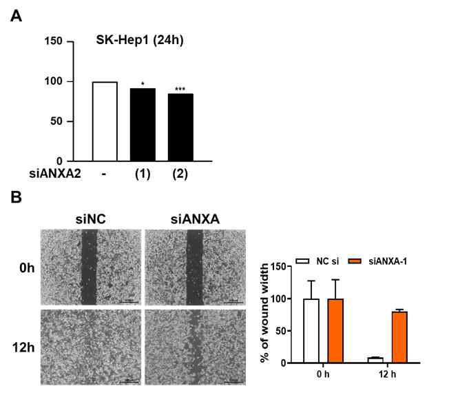 남성 간암세포주(SK-Hep1)에서 SAL의 효과 및 Annexin A2의 연관성