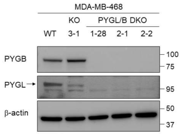 구축된 PYGB KO 및 PYGL/PYGB DKO 세포주의 검증