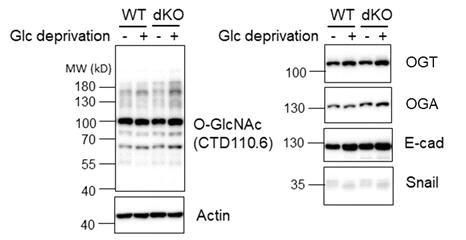 MDA-MB-468 야생형 세포와 PYGB/PYGL 이중결손(dKO) 세포의 O-GlcNAc 수식화와 주요 단백질 발현량 비교