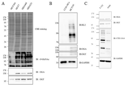 다양한 조직별 정상 세포와 암세포의 O-GlcNAc 수식화 비교