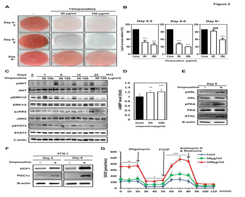 3T3-L1세포에 vinpocetine 처리에 의해 지방세포분화 촉진 억제 (A), 지방산 축적 억제 (B), 지방세포분화 촉진 세포신호 감소 (C), cAMP 활성 증가 (D), 지방분해효소의 활성 및 발현 증가 (E), UCP1 발현증가 (E)와 산소소비량 증가 (F)