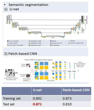 종양 자동 분할을 위해 이용한 딥러닝 알고리즘 및 dice coefficient 결과표