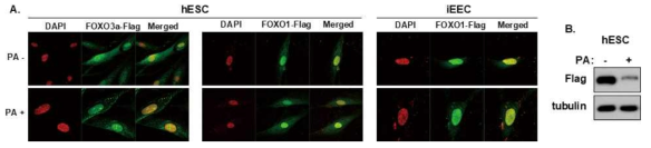 사람자궁내막세포 및 표피세포에서의 PA 처리에 의한 FOXO1과 FOXO3a의 발현 변화 확인