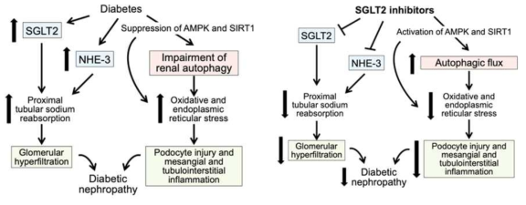 (좌) Proposed pathways by which diabetes can cause chronic kidney disease. (우)　Novel pathways by which SGLT2 inhibitors can ameliorate renal injury in patients with type 2 diabetes [Ref.14]