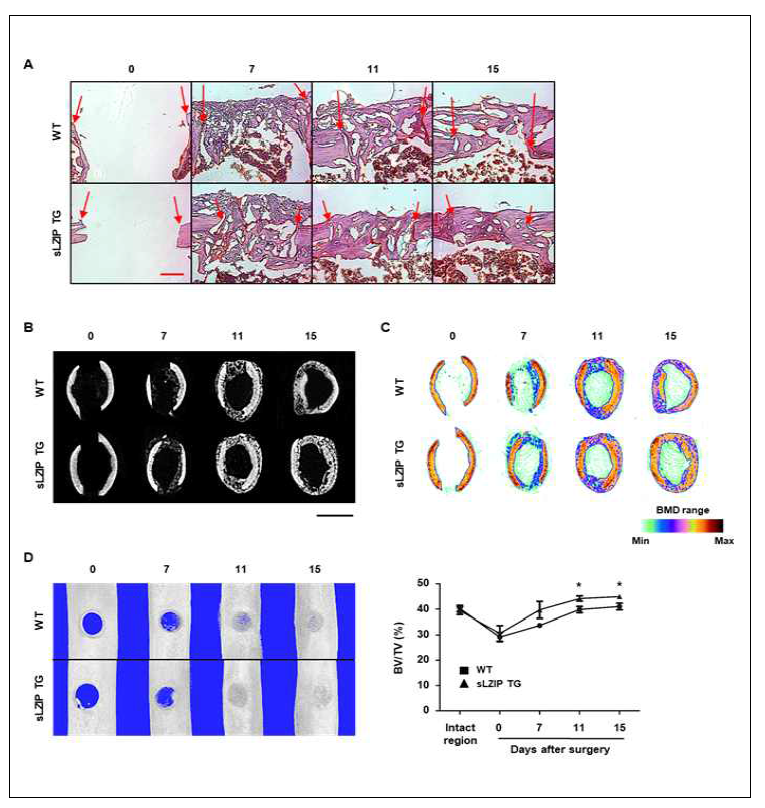 sLZIP 발현에 따라 향상된 fracture healing