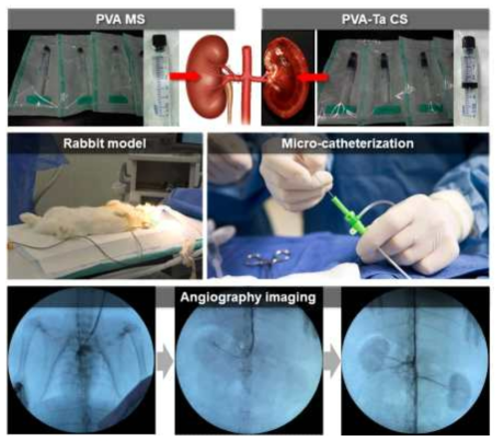 토끼 색전 동물모델에 대한 Catheter 시술법