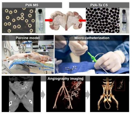 돼지 자궁 색전 동물모델 실험 모식도