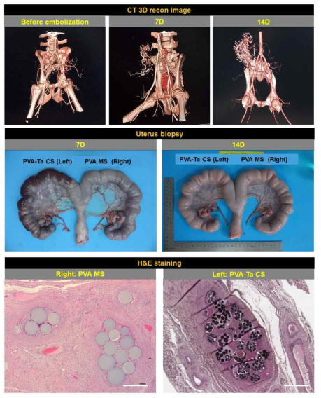 CT recon 및 H&E staining 평가에 의한 PVA-Ta CS의 방사선 불투과성 특성 분석 및 혈관 색전능 확인