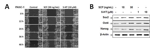 SCF와 5-HT의 췌장암세포 PANC-1의 이동 유도 및 줄기성 전사인자 발현 유도 효과