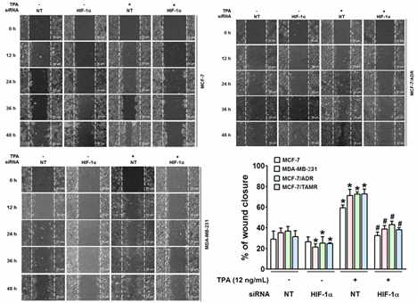 HIF-1α silencing에 의한 MCF-7, MCF-7/ADR, MCF-7/TAMR의 이주 억제 효과