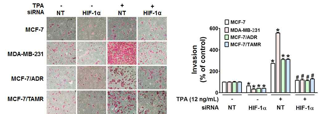 HIF-1α silencing에 의한 MCF-7, MCF-7/ADR, MCF-7/TAMR의 침윤 억제 효과