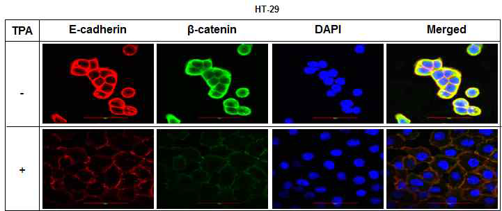 대장암세포(HT-29)에서 TPA에 의한 E-cadherin 및 β-catenin 발현 감소
