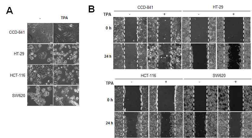 전이능이 차이에 따른 대장암세포주의 TPA에 의한 암세포 이동 현상