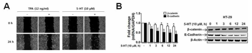 대장암세포주 이주에 미치는 TPA와 5-HT의 효과 및 유전자(E-Cadherin 및 β-catenin) 발현에 미치는 5-HT의 효과