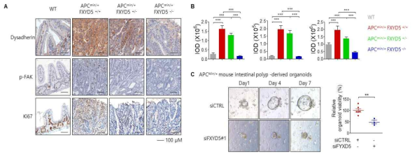 Dysadherin-Integrin 신호축의 암 병태생리 조절 효과