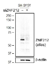 SH-SY5Y에서 ZNF212 발현확인