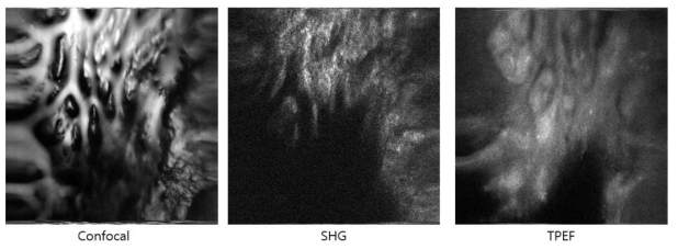 돼지 피부를 이용한 Confocal (좌), SHG(중간), TPEF(우) 영상 획득