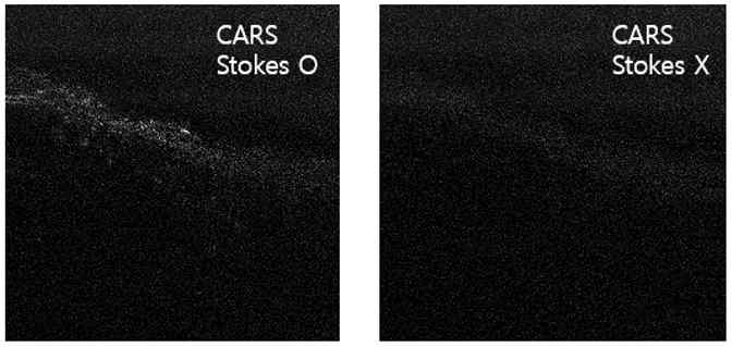 stokes 유무에 따른 CARS 신호 확인