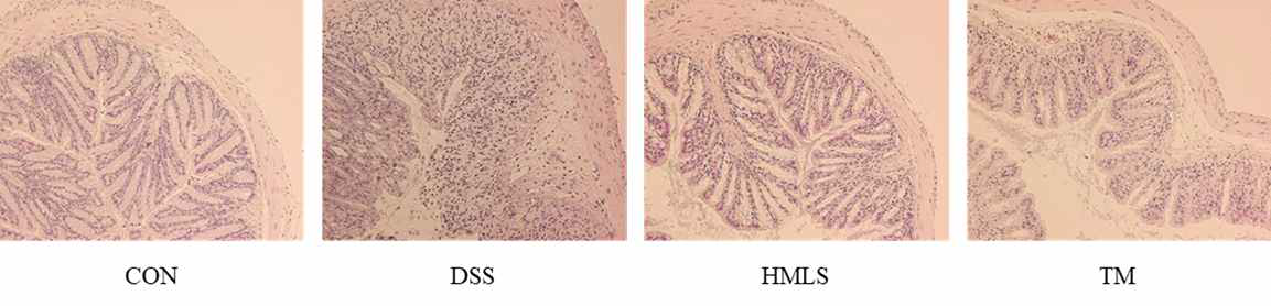 The efffect of DSW on colonic histopathological changes