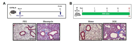 폐섬유화를 유도하는 마우스 모델 제작. A, bleomycin 유도 폐섬유화 마우스모델; B, TGF-β-TG 폐섬유화 마우스 모델