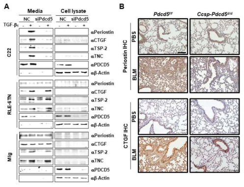 PDCD5 의존적 matricellular protein의 세포분비가 club cell에서 특이적으로 관찰됨