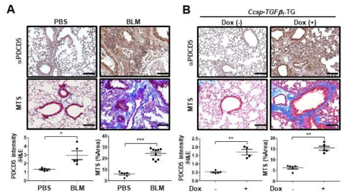 폐섬유화 동물모델에서의 PDCD5의 발현패턴