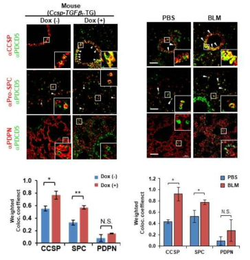 PDCD5의 세포별 발현변화 검토 (CCSP/Uteroglobin: club cell, Pro-SPC: AT2 cell, PDPN: AT1 cell, Muc5AC: goblet cell)