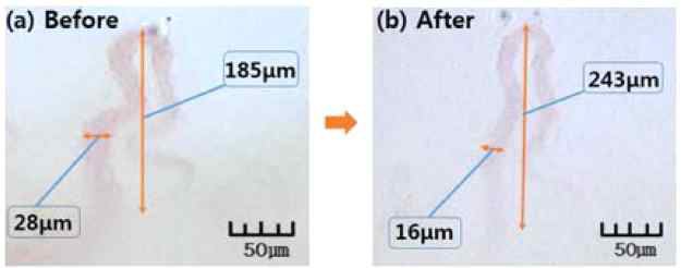 모세혈관의 길이와 폭의 변화 비교