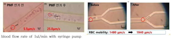 미세채널 내에서 PMF 인가 후 혈류속도 증가함