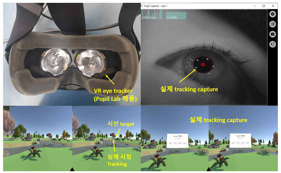 가상현실(VR)-eye tracking 기반 전정재활프로그램. 가상현실 인터페이스 하에서 정해진 머리 회전 및 안구 회전을 유도하고, 머리 회전-안구 회전 비율을 측정하여 전정-안반사, 안구 운동을 세분화 하여 계산하는 통합 솔루션을 제작함. 이를 바탕으로 맞춤형 기능적 게임 형식의 재활프로그램을 제작함