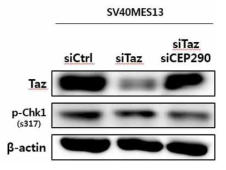 TAZ, CEP290 double knockdown 된 세포에서 p-CHK1 level의 증가 관찰