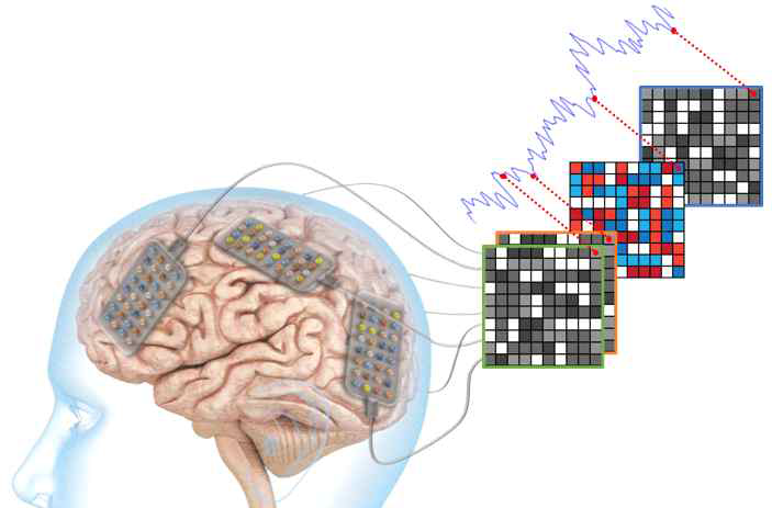 다채널 전극을 이용한 3차원 신경신호 데이터