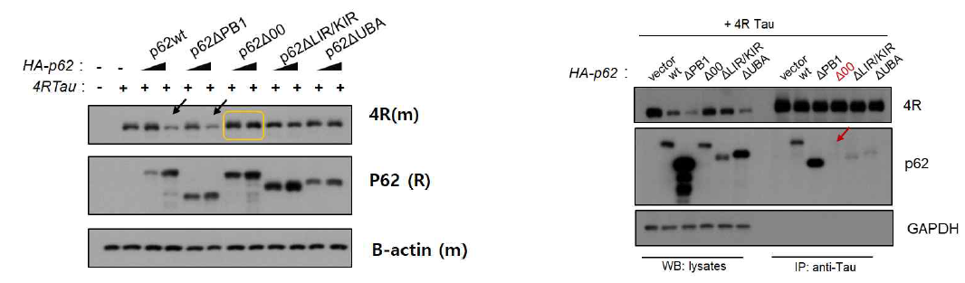 Mutant constructs를 이용한 실험에서 00도메인의 없는 p62 construct 의 경우는 Tau 단백 감소가 이루어지지 않음 (노랑). 이는 co-immunoprecipitation에서 확인된 것처럼. 00 도메인을 통해서 Tau 단백과 p62 단백 사이의 직접 결합이 이루어지기 때문임을 검증함