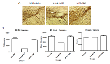 Ewha-7240에 의한 TH의 발현과 dopaminergic neuron의 감소억제