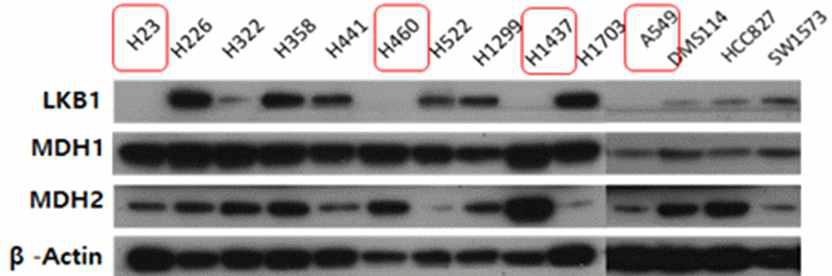 폐암세포주에서의 LKB1, MDH1, MDH2 발현양 비교 분석