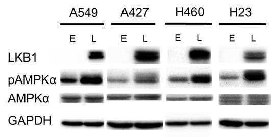 폐암세포주에 LKB1 도입 후 발현 확인. E: empty control 세포주 (LKB1-deficient), L:LKB1 발현 세포주(LKB1-proficient)