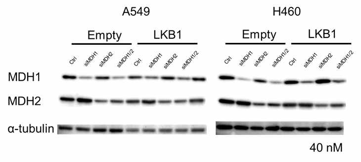 MDH1/MDH2 knock-down시 MDH1/MDH2 발현억제 확인
