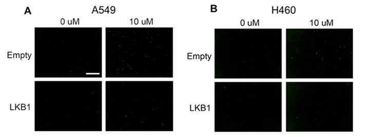 LKB1-deficient 세포주의 MDH1/2 저해제 LW-L2136에 의한 세포사멸 민감성. A. A549. B. H460. Scale bar = 300 um