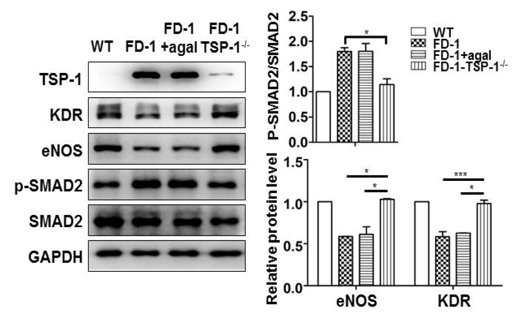 파브리병 환자 세포 내 TSP1 유전자 결손으로 인한 혈관병증 완화. 혈관형성인자 (KDR, eNOS) 발현이 TSP1 유전자 결손시 증가하였고, SMAD2 신호전달체계 활성히 감소하였음