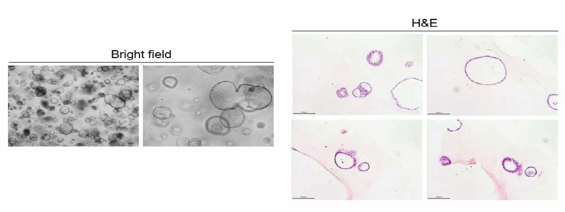 신장 조직 유래의 3D 오가노이드의 형태학적 분석 및 H&E 염색 결과
