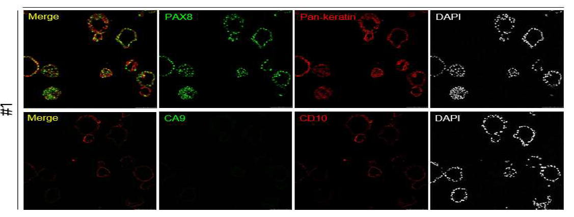 신장 조직 유래의 3D 오가노이드에서 신장 특이 마커에 대한 면역형광염색 결과
