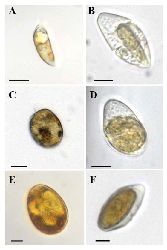 본 연구에서 새롭게 확인한 Prorocentrum 속 내의 3종, P. triestinum, P. rhathymum, 그리고 P. lima를 포식한 Gyrodinium dominans의 세포 사진. (A) P. triestinum, (B) P. triestinum을 섭식한 G. dominans, (C) P. rhathymum, (D) P. rhathymum을 섭식한 G. dominans, (E) P. lima, (D) P. lima를 섭식한 G. dominans. Scale bars= 10 μm