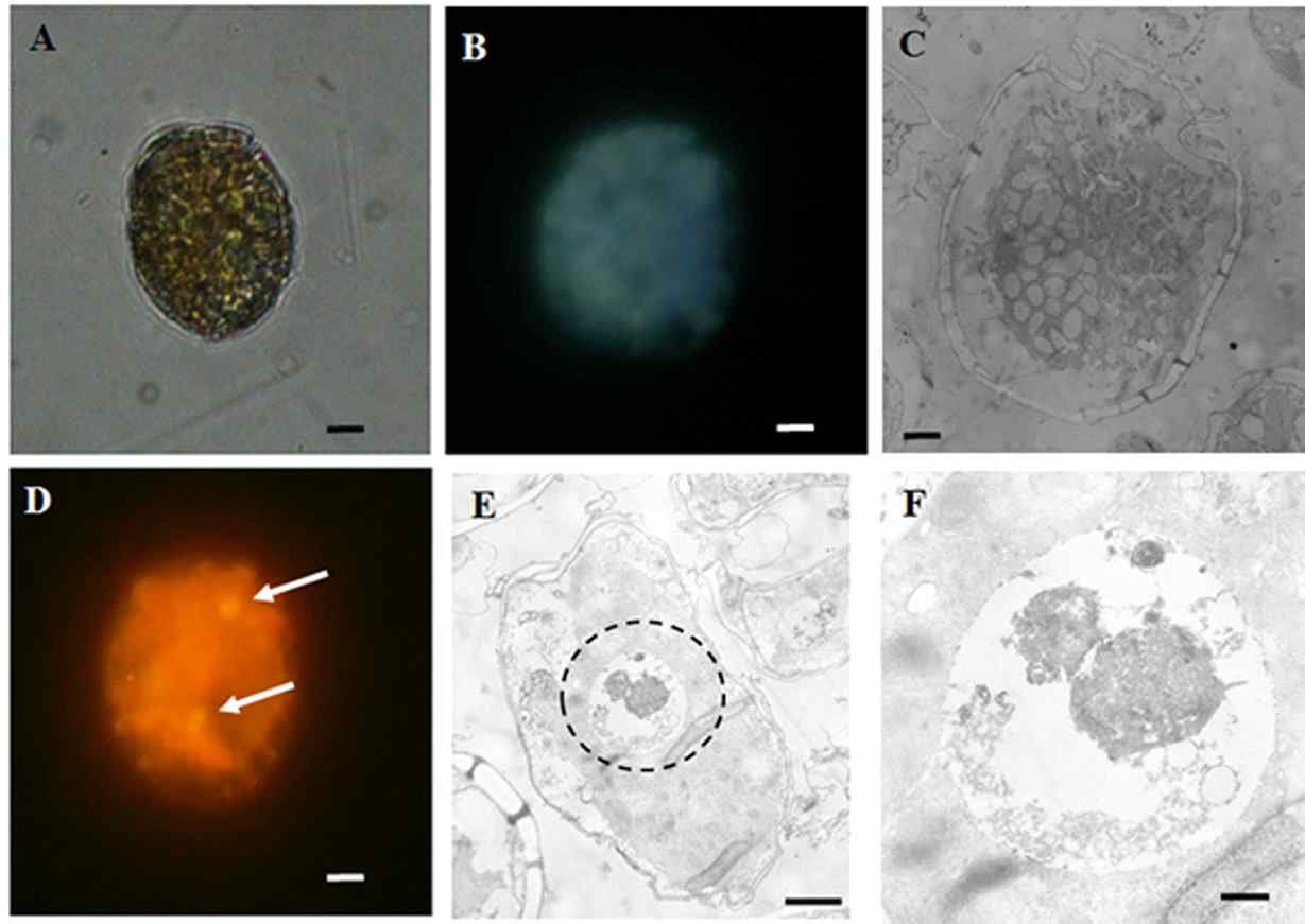 혼합영양성 와편모류 Thecadinium kofoidii (Yoo et al. 2018b). (A) 먹이를 섭식하는 않은 T. kofoidii 광학현미경, (B) 형광현미경, (C) 투과전자현미경 (TEM) 사진. (D) T. kofoidii가 광영양 세균을 섭식한 형광현미경사진. (E & F) T. kofoidii가 저서 은편모류인 Rhodomonas salina을 섭식한 TEM사진