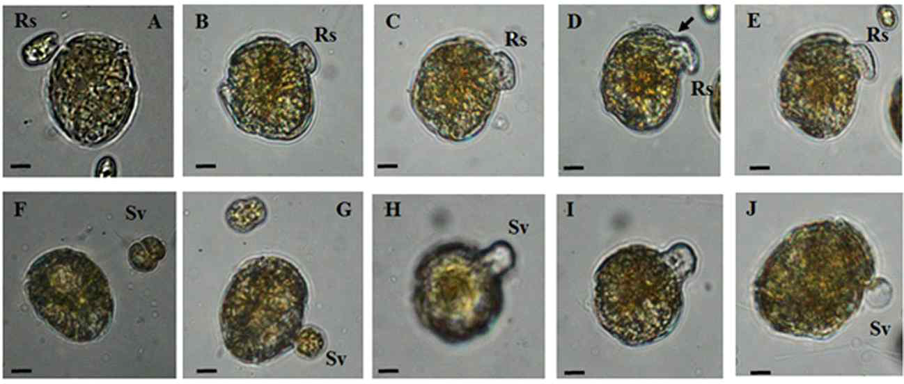 혼합영양성 와편모류 Thecadinium kofoidii이 저서 플랑크톤인 Rhodomonas salina (Rs; A-E)와 Symbiodinium voratum (Sv; F-J))를 섭식관(peduncle)을 이용하여 섭식하는 과정 (Yoo et al. 2018b)