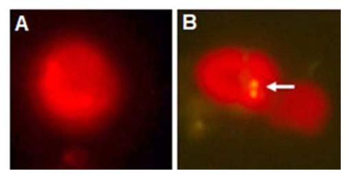 녹조류 Tetraselmis sp.가 광영양 세균을 섭식한 형광현미경 사진 (Nagarkar et al. 2018)