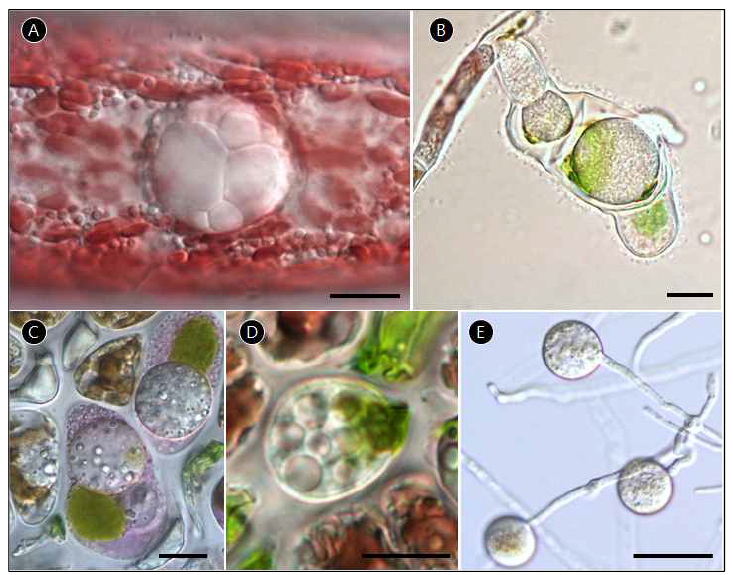 본 연구에서 채집된 난균강 원생생물 A Olpidiopsis sp. 2. B Olpidiopsis sp. 1. C Olpidiopsis koreanae. D Olpidiopsis pyropiae. E Pythium porphyrae. Scale bar=10㎛